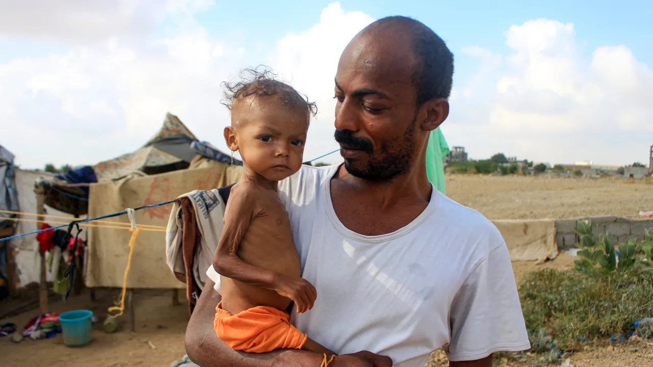 Een ondervoede baby in Jemen