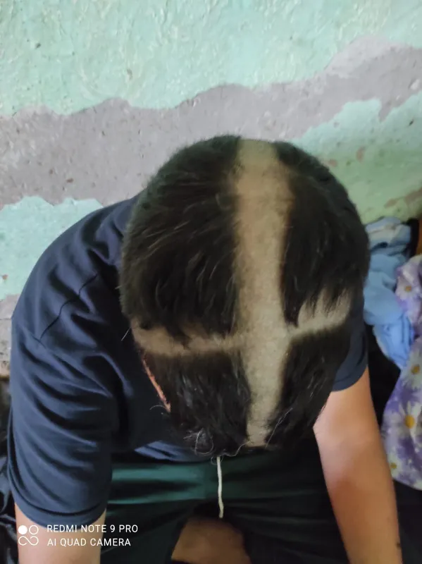 Slachtoffer van pushback: 'Waarom schoren ze mijn hoofd?'